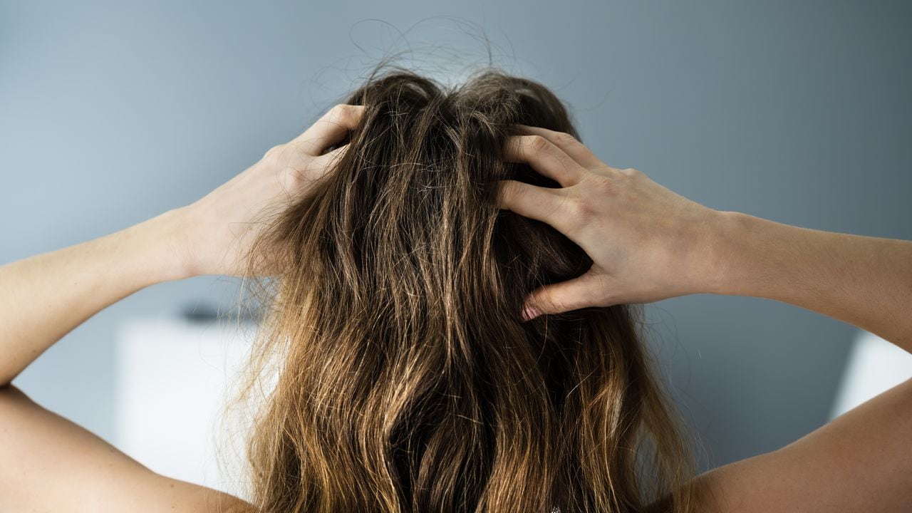 Itching Dry Head Scalp And Long Hair With Dandruff