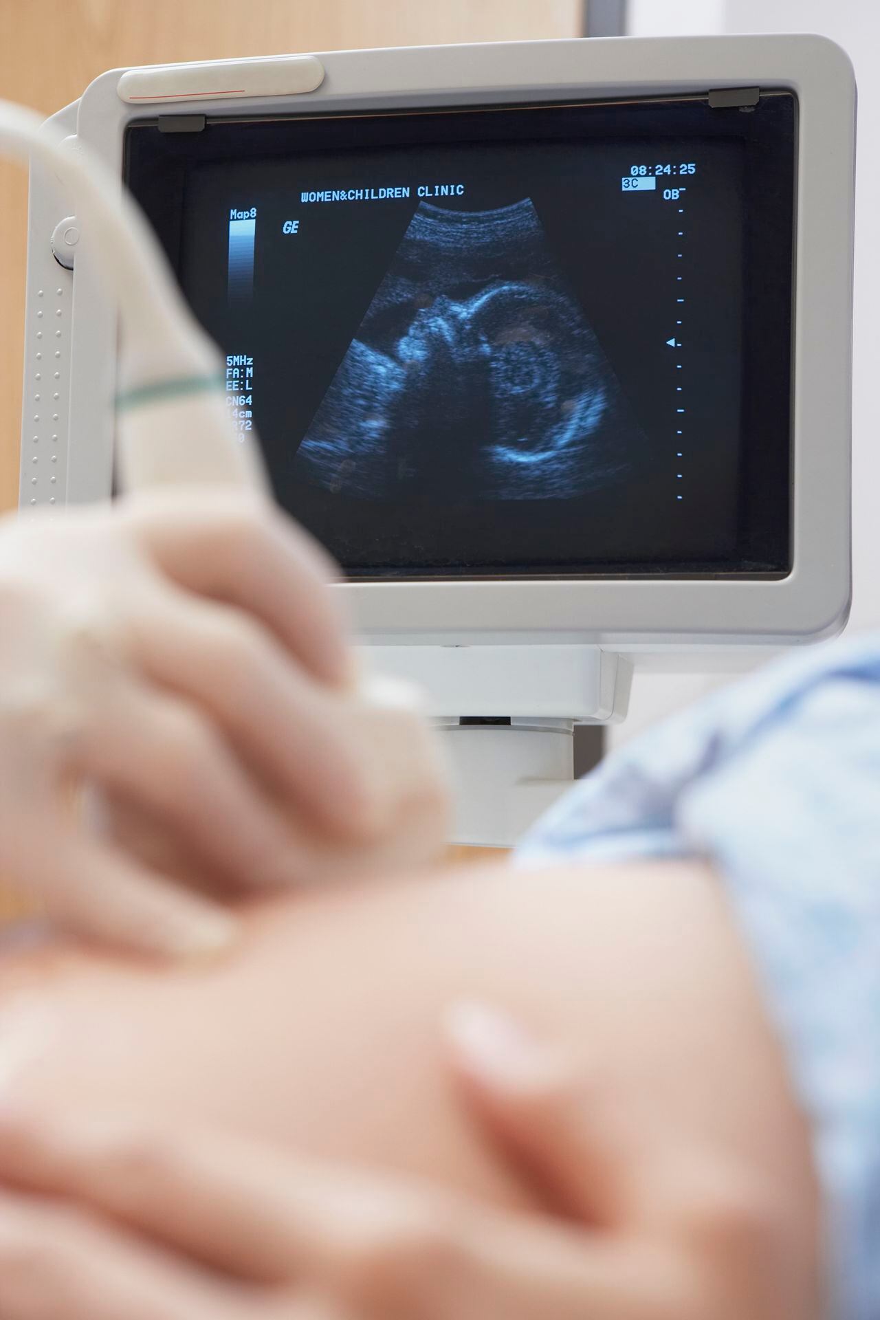 Close up of pregnant woman having ultrasound