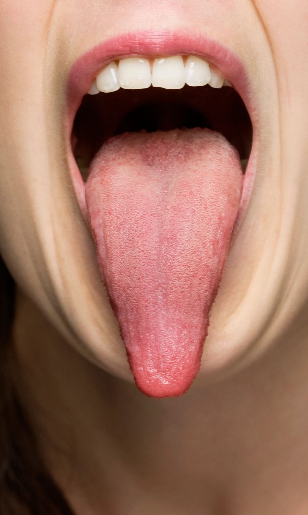 ¿Qué revela la lengua sobre la salud?