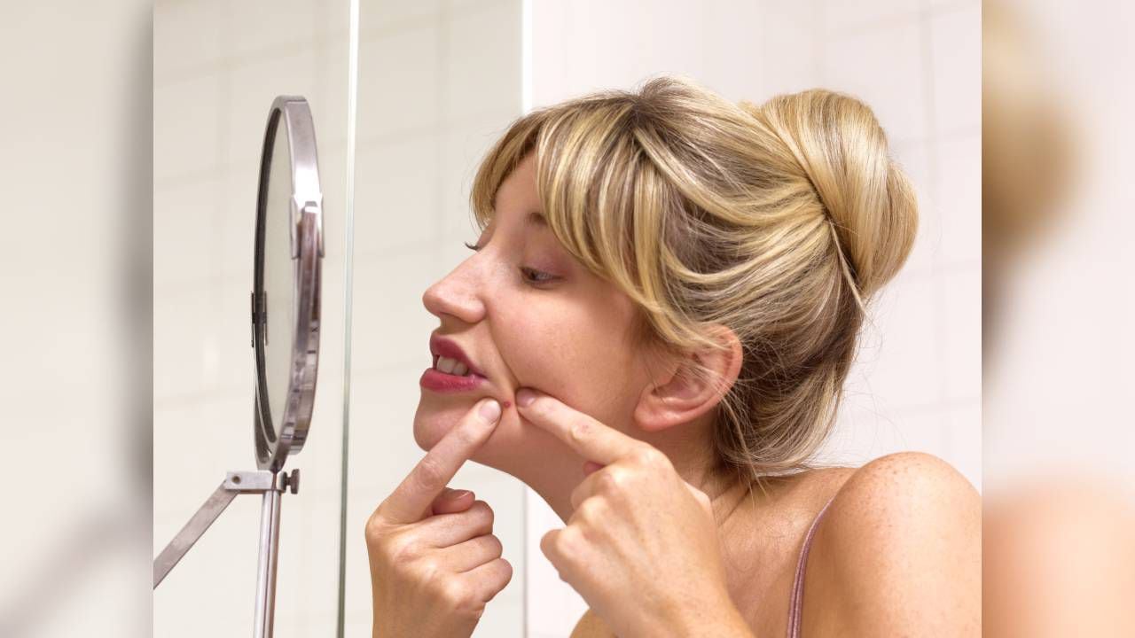Expertos recomiendan eliminar el hábito de apretar los granos de acné. Foto: GettyImages.