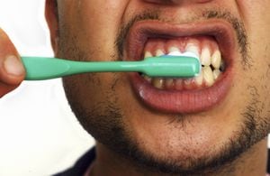 Close-up of young man brushing his teeth, Regular brushing of teeth helps prevent tooth decay and gum disease. (Photo by Universal Images Group via Getty Images)