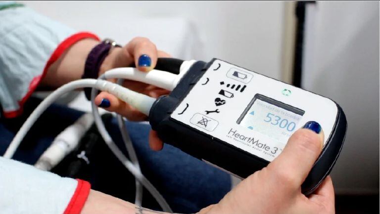 Controlador que ayuda a monitorear el desempeño del corazón artificial.