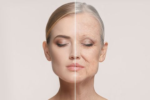 Las arrugas son parte del envejecimiento natural de la piel.
