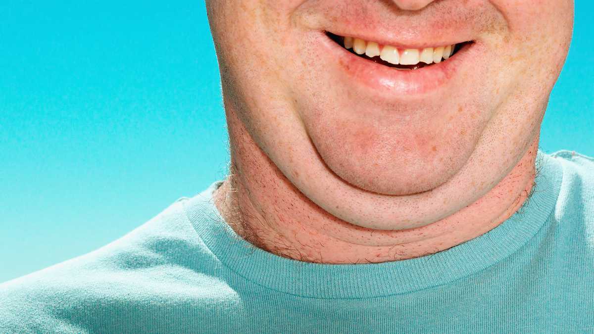 Chin: Home Remedy to Eliminate It, So It Can Be Prepared