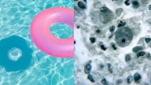 El parásito se puede contraer en piscinas.