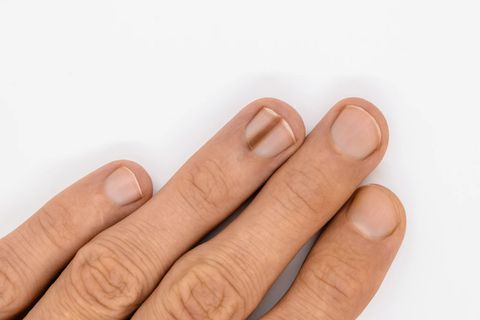¿Por qué salen líneas negras en las uñas?