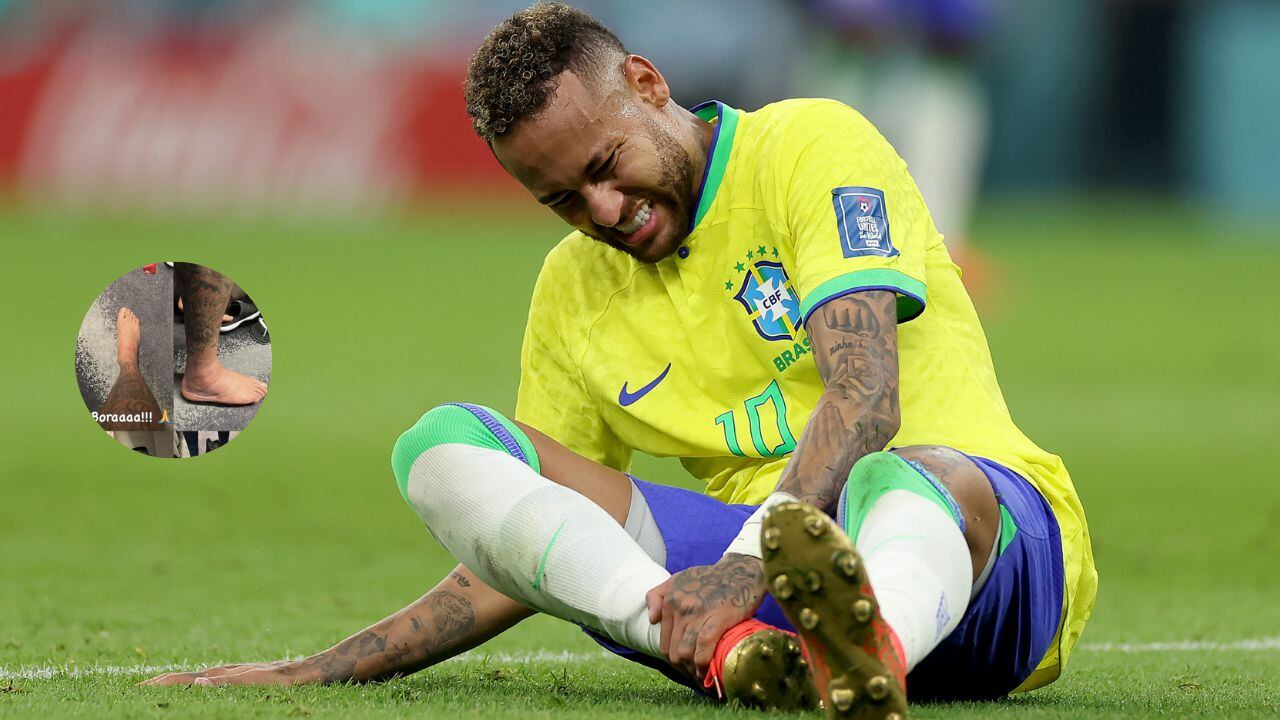 Neymar mostró su tobillo tras algunos días de su lesión.