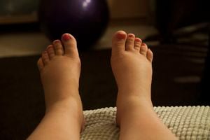Los pies inflamados pueden aliviarse utilizando algunos remedios caseros.