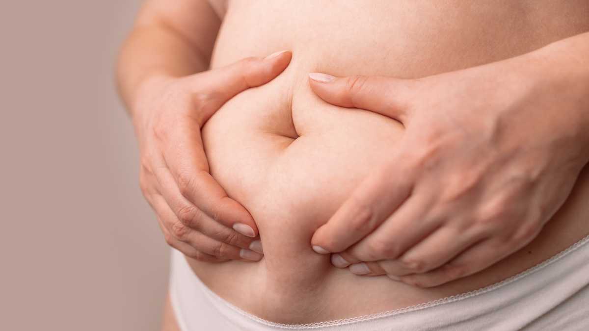 Flabby skin on a fat belly, plastic surgery concept on gray background