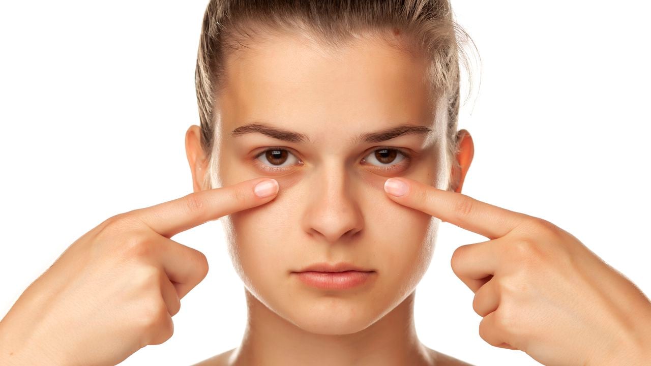 Descubra cómo disminuir las bolsas de los ojos utilizando remedios naturales y su correcta preparación