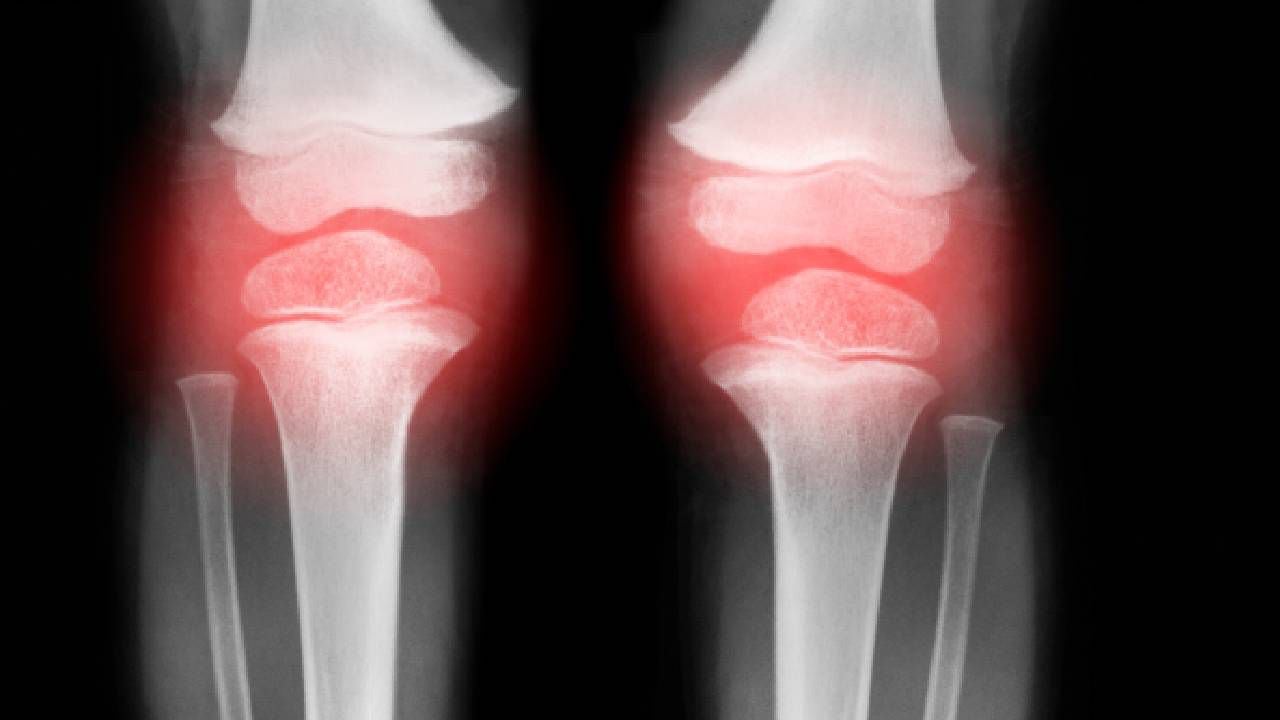 En ocasiones los dolores de rodilla no son fuerte, pero si pueden ser molestos. Foto: Getty images.