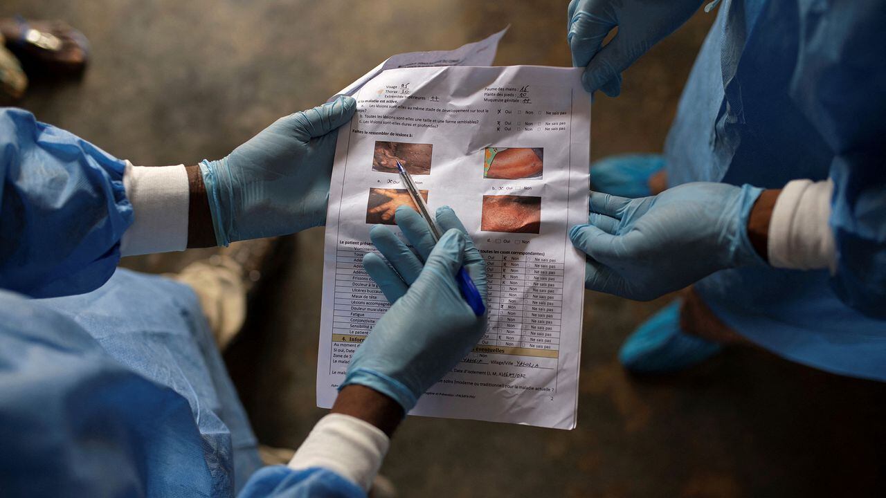 En imágenes : En el brote de viruela del mono en África, la enfermedad y la muerte pasan desapercibidas