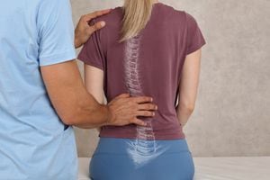 Escoliosis Anatomía de la curva de la columna vertebral, corrección de la postura. Tratamiento quiropráctico, alivio del dolor de espalda.