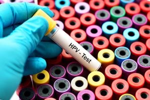 Muestra de sangre para la prueba del VPH