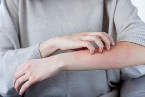 La picazón en la piel puede ser causada por varios factores.
