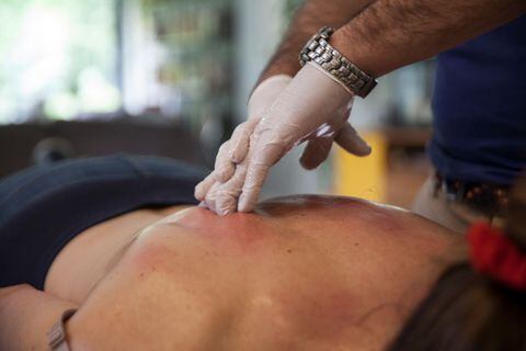 Fisioterapeuta realiza un masaje terapéutico de tejido profundo