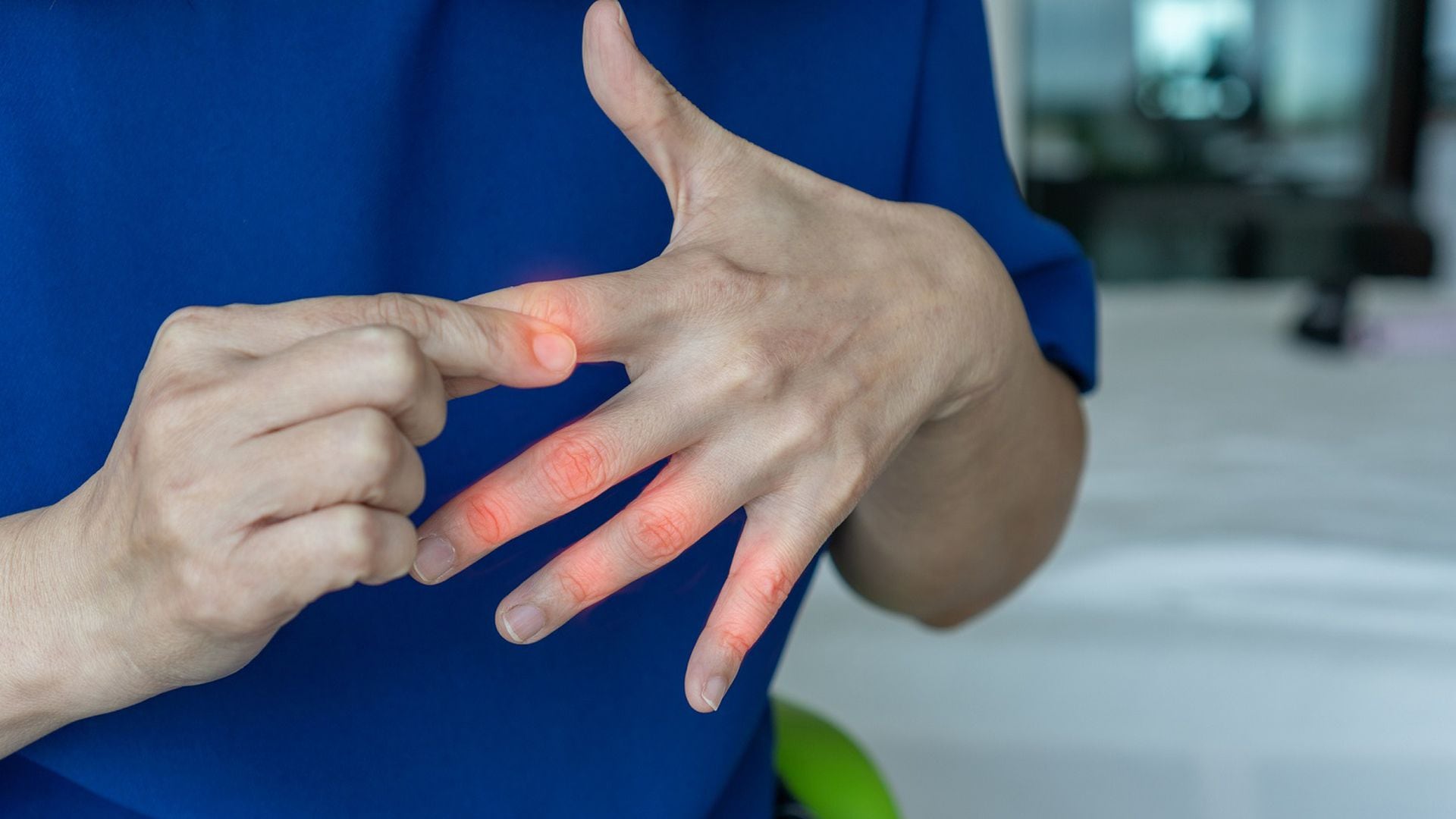 A escala nacional Humanista reputación Artrosis de manos: así se puede evitar la deformación de los dedos de las  manos