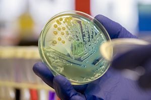 Esta bacteria suele transmitirse por contacto con la piel, mucosas, heces, heridas u orina de una persona infectada.