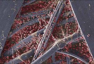 Micrografía de un esparadrapo que se utilizó para tratar un corte con cuchilla de afeitar. Los glóbulos rojos y las fibras finas de la fibrina, la proteína, de color beige, se pueden ver entre las fibras de la gasa del yeso, de color azul-gris.