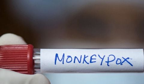Colombia también está entre los primeros países con más contagios de viruela de mono.