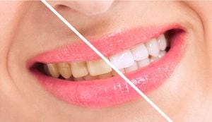 Algunas frutas oscuras pueden generar manchas en los dientes si se no se realiza un buen aseo bucal luego de ingerirlas.