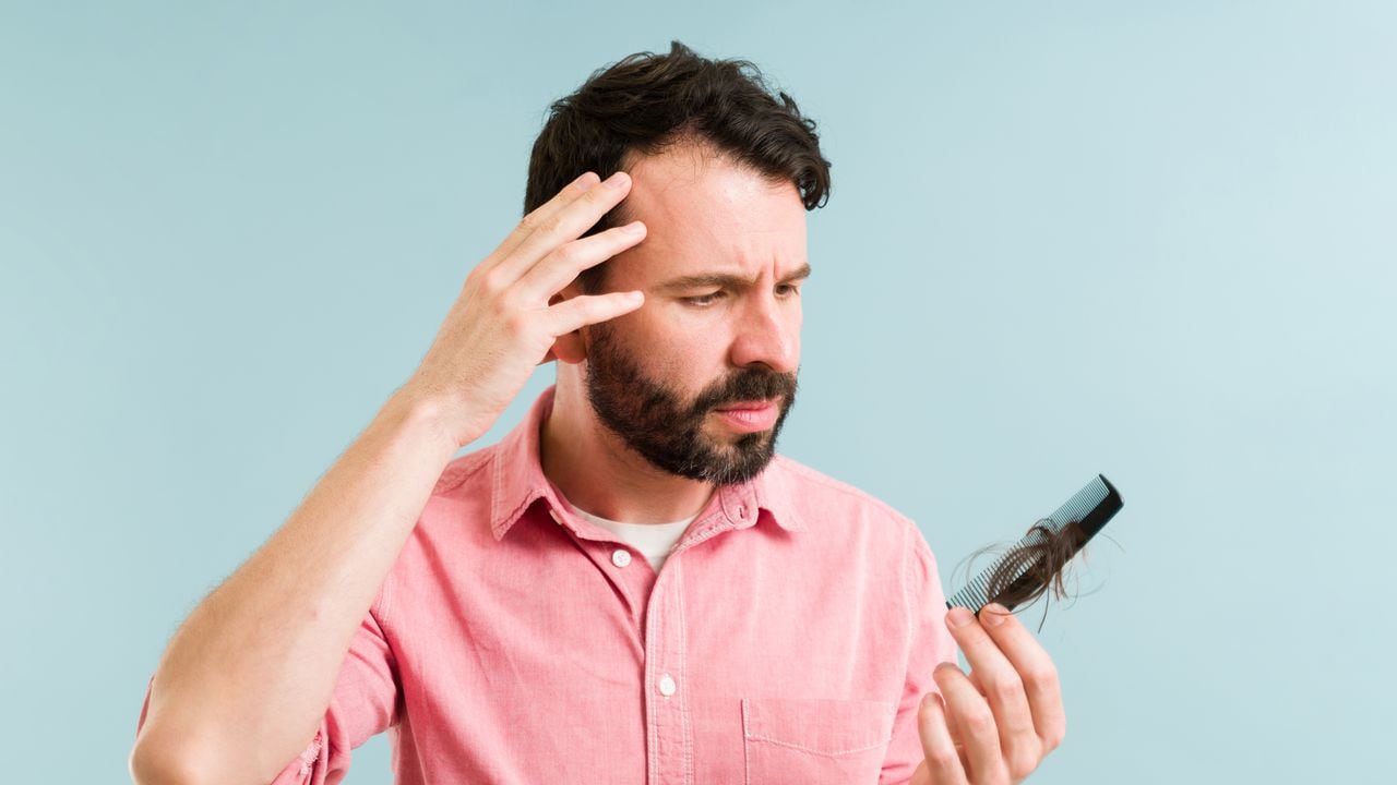 La pérdida de pelo puede estar relacionada con un déficit en la alimentación.Pérdida de pelo por falta de vitaminas