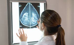 Unrecognizable female gynocologist looking at a patients mammogram at the hospital