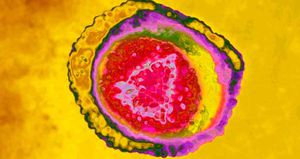 El virus del herpes humano tiene ocho cepas. La 1 causa herpes labial, pero también puede ser encontrada en los genitales; la 2 causa herpes genital, la 3, varicela y herpes zoster; la 4 (o EBV), mononucleosis infecciosa y linfoma de Burkitts; la 5 o citomegalovirus causa el síndrome de la mononucleosis; la 6 y la 7, roséola y la 8 causa sarcoma de Karposis y linfoma.