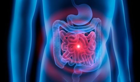 Una de las principales afectaciones del intestino grueso es el llamado colon irritable.