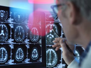 Doctor viendo escáneres cerebrales para posibles enfermedades o daños  - Imagen de referencia