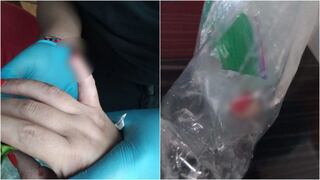 Video: por una máquina de ejercicio, mujer le arrancó el dedo a otra en reconocido gimnasio