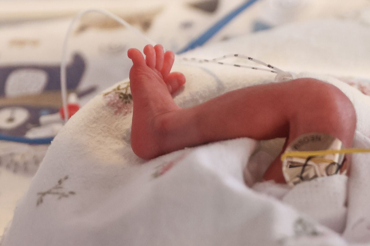 La pierna de un bebé prematuro. Imagen de referencia