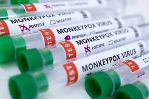 FILE PHOTO: Test tubes labelled "Monkeypox virus positive and negative" are seen in this illustration taken May 23, 2022. REUTERS/Dado Ruvic/Illustration/File Photo
