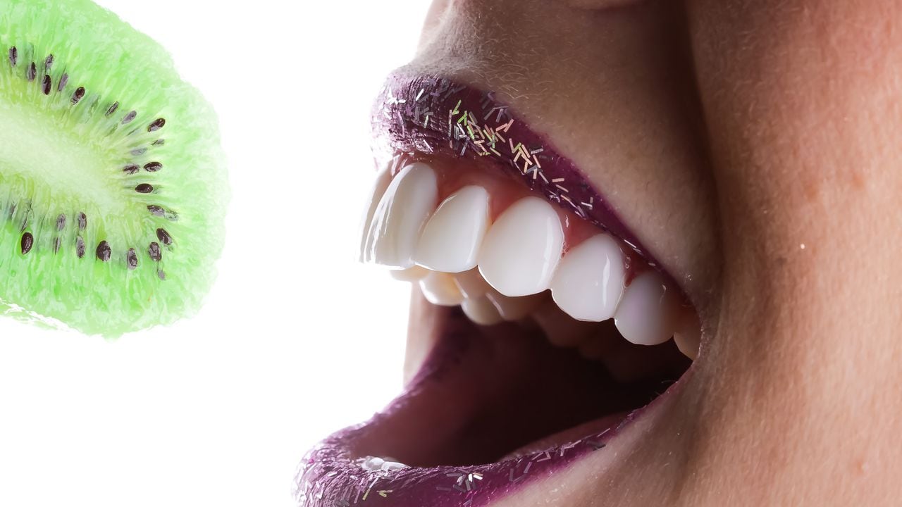 Las carillas dentales mejoran la apariencia de la sonrisa