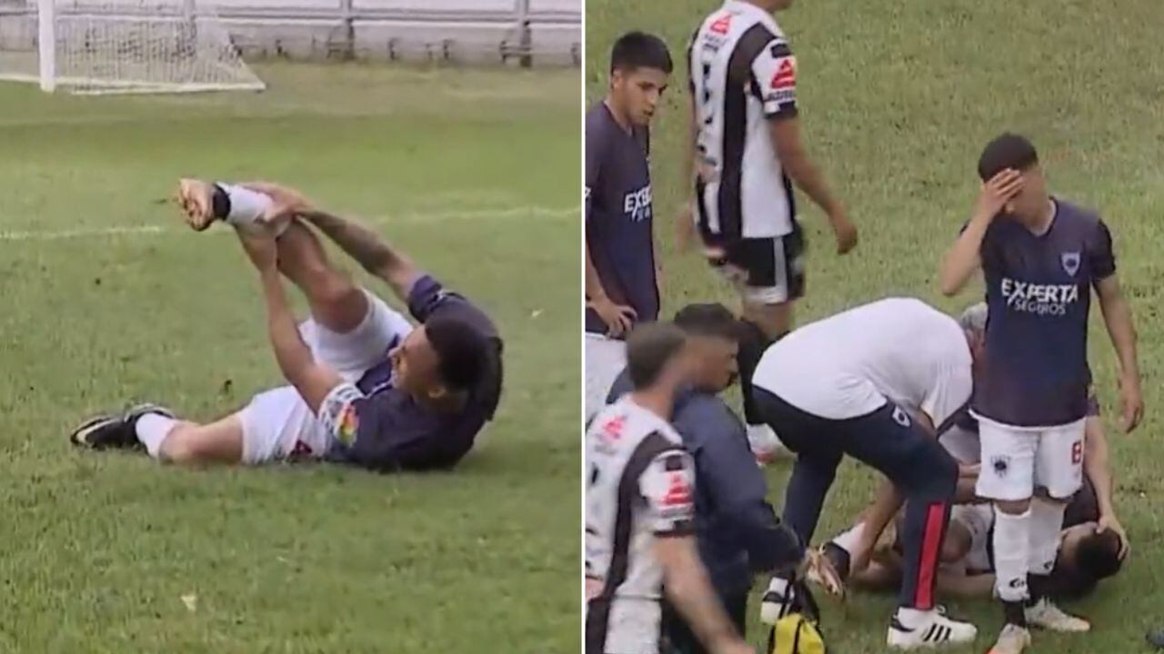 Brutal lesión de futbolista durante partido (VIDEO) 