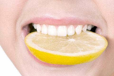 El limón, aunque saludable, puede causar erosión del esmalte dental debido a su alta acidez