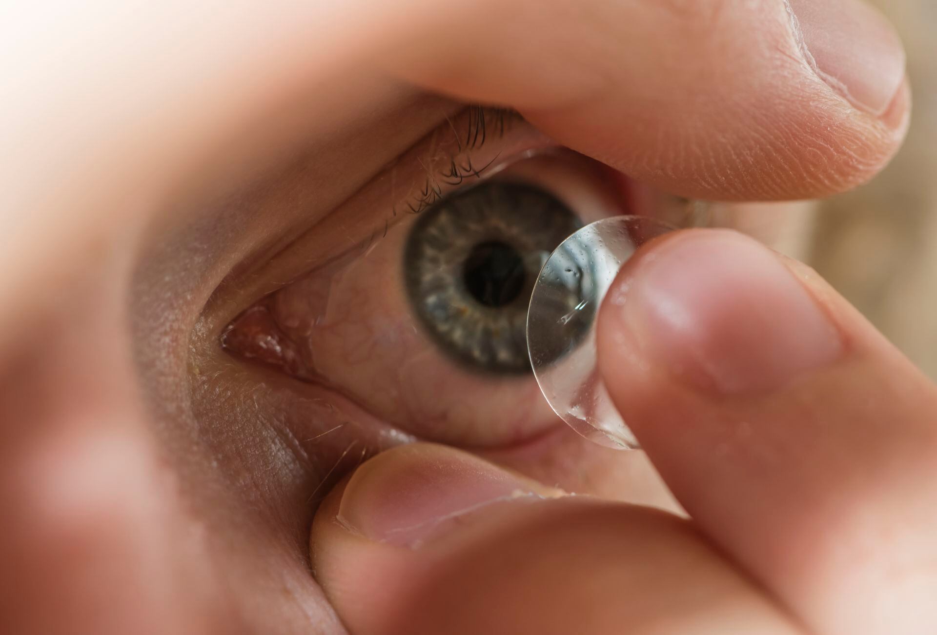 De Verdad Deportista demandante Estas son las enfermedades más frecuentes que causa el uso de lentes de  contacto