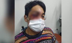 Mala atención médica y silencio frente al caso de joven afectado por proyectil de la policía en protestas en Perú