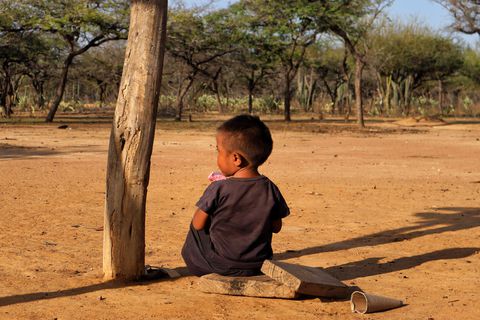 Niño wayúu con desnutrición crónica.