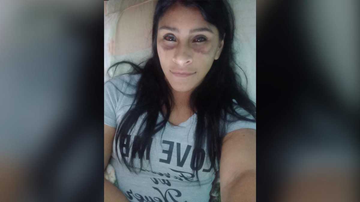 Mujer fue víctima de una brutal golpiza en Itagüí propinada por su exnovio