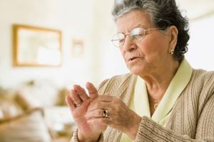 La artritis reumatoidea es una enfermedad autoinmune.