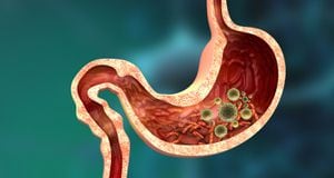 Los parásitos intestinales pueden generar síntomas como diarrea, estreñimiento y cambio de color en las heces.