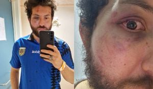 Sergio Ramírez fue golpeado presuntamente por guardas de seguridad de algunos bares de Malta después de la final del Mundial entre Argentina y Francia