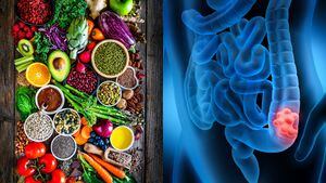 Nutriente para prevenir el cáncer de colon