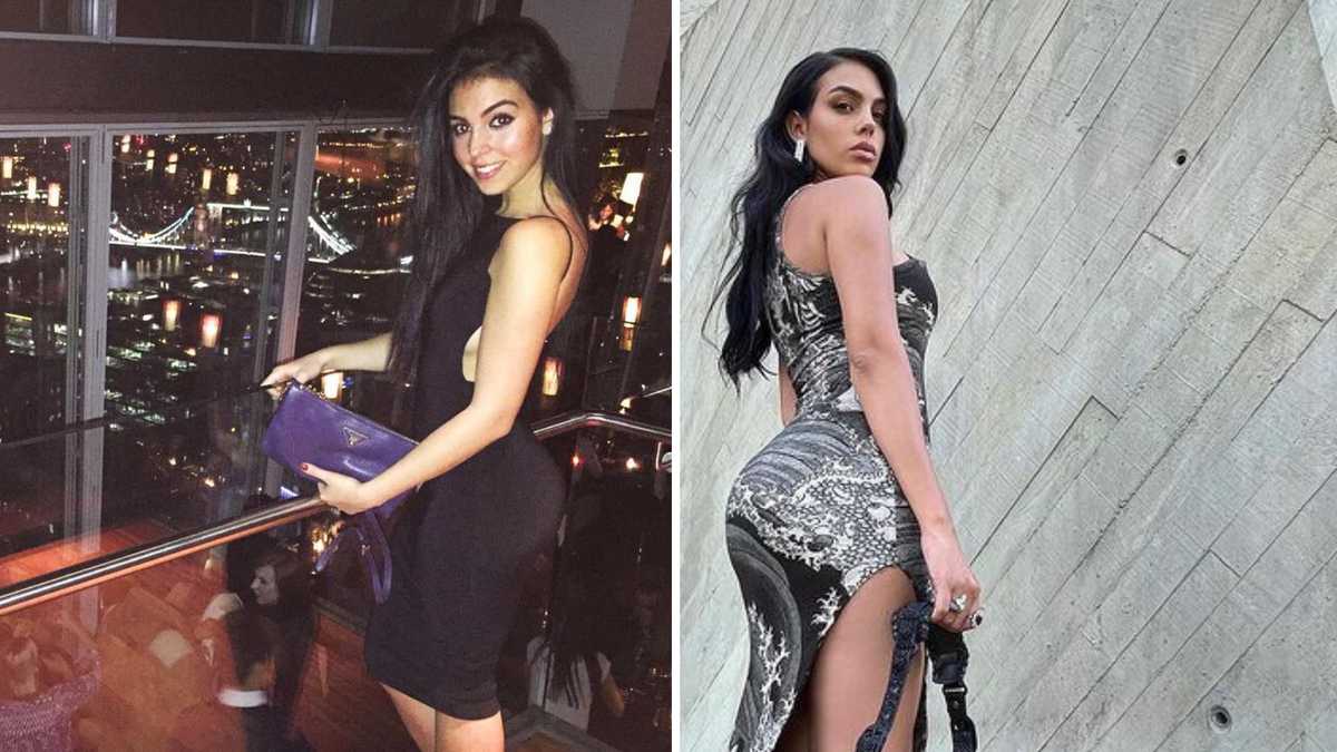 El antes y después de las cirugías de Georgina Rodríguez