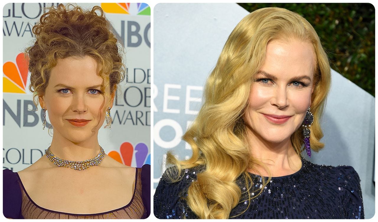 "Qué se hizo Nicole Kidman en la cara?", es una de las búsquedas más frecuentes en Google.