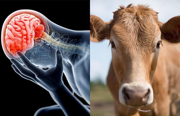 Si un humano entra en contacto con un bovino con la enfermedad, tendrá serias complicaciones en el sistema nervioso.