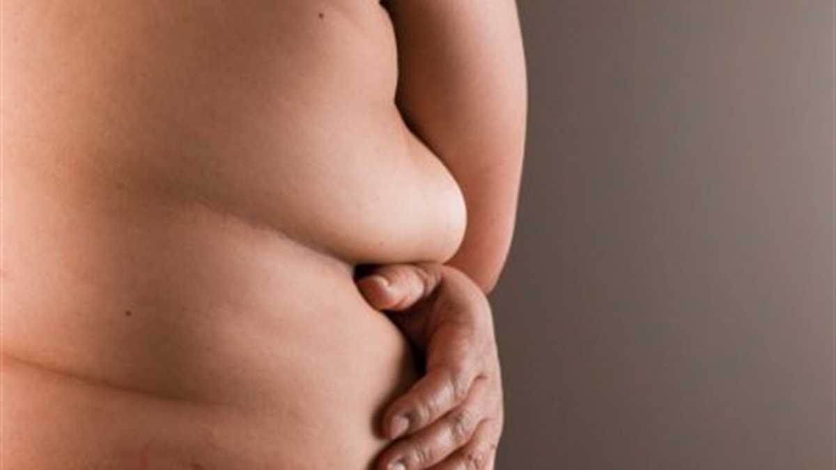 El sobrepeso y la obesidad aumenta el riesgo de sufrir diferentes afecciones de salud. Foto. Thinkstock