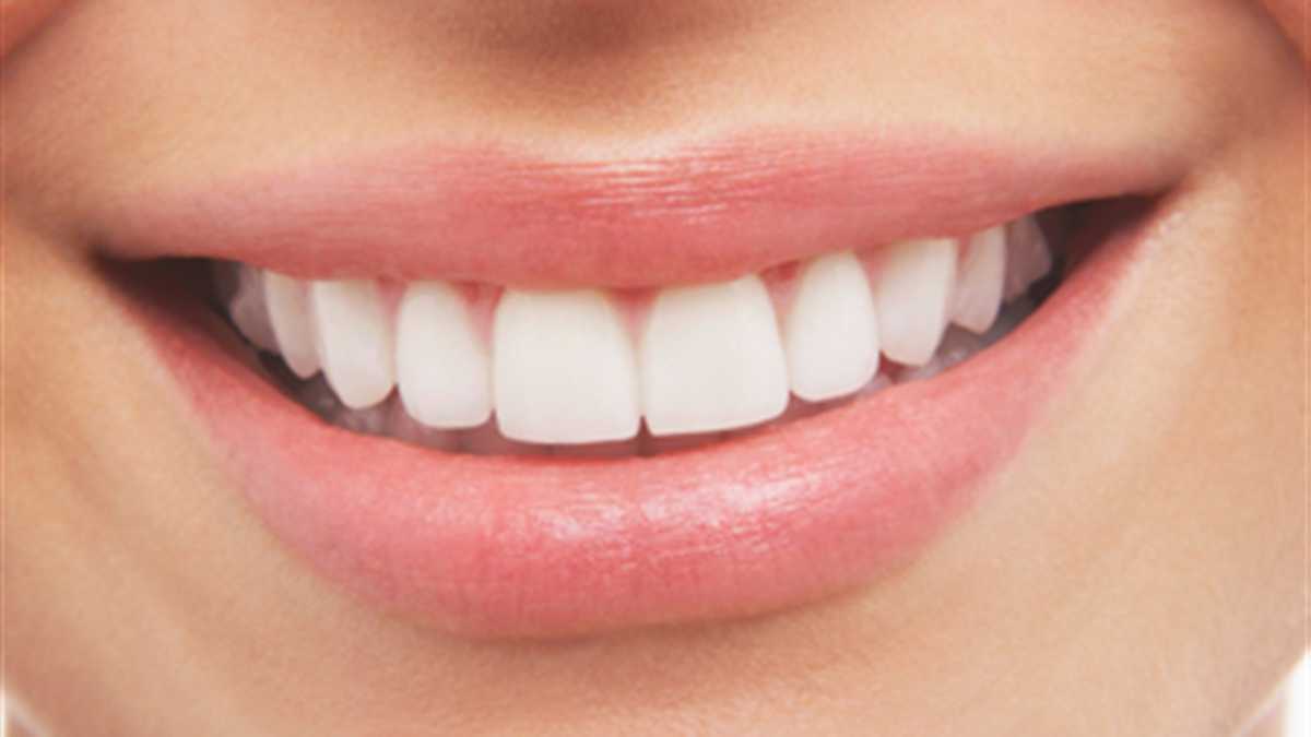 Los dientes, generalmente, son de un color blanco amarillento. Algunas personas acuden a procesos especializados para hacerlos completamente blancos.