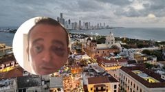 Turista italiano denunció que fue víctima robo en Cartagena.